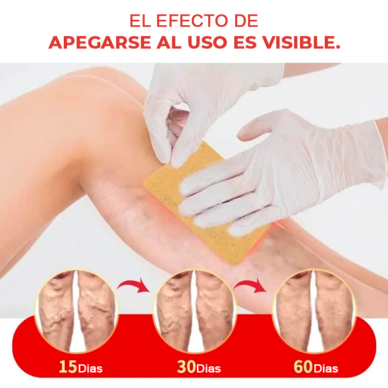 Veins Parche Anti-varices [Compre 6 lleve 12]