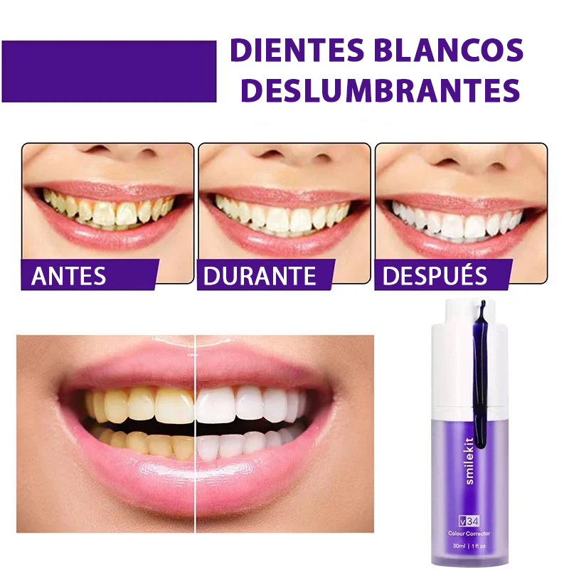 Blanqueador Dental Smile® - Dientes Blancos En Segundos